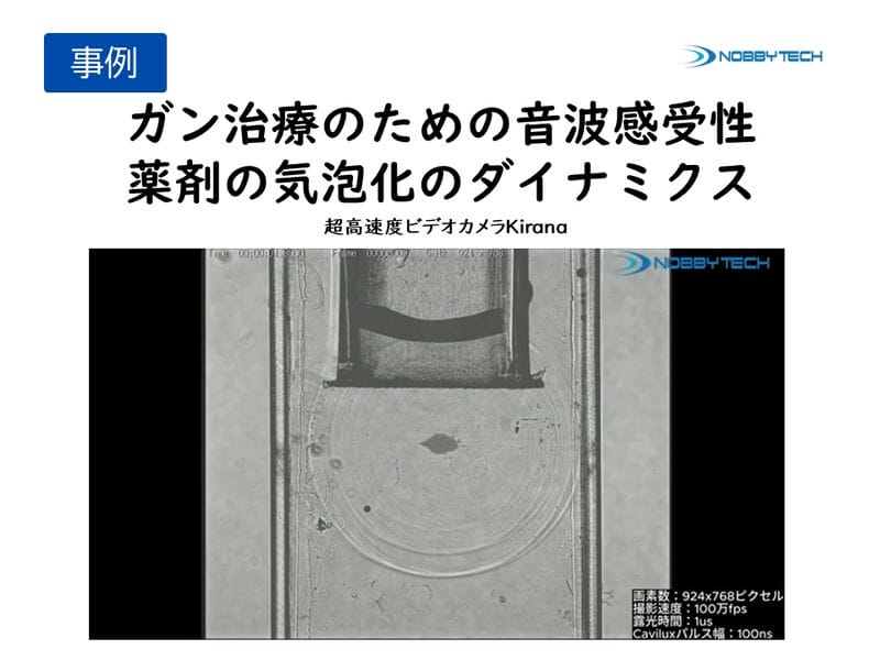 ガン治療のための音波感受性薬剤の気泡化のダイナミクス